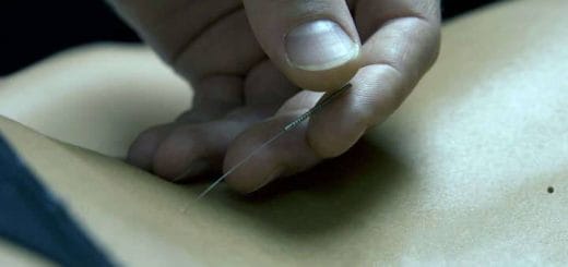 Acupuncture for weight loss and losing weight