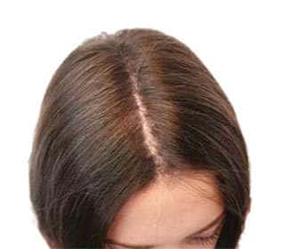 Biotin for hair