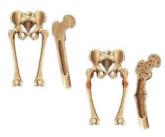 Calcium absorption in bones
