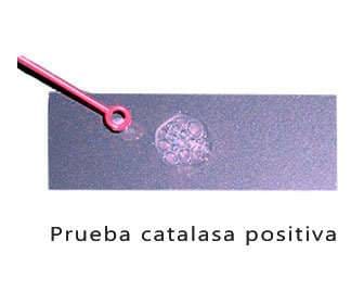 Positive and negative catalase test