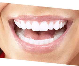 Hydrogen peroxide for teeth, dental whitening Dental whitening