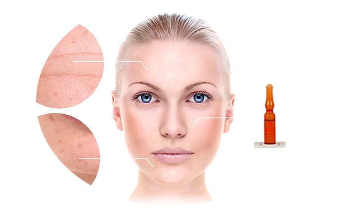 Endocare c20 Endocare C20 proteoglycans and vitamin C in ampoules Endocare C20 proteoglycans