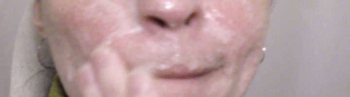 What acetylsalicylic acid is used for, what it is, dosage, uses, and properties Acetylsalicylic acid and aspirin mask