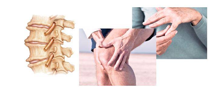Ginger, Medicinal Properties and Benefits, Effects, and Ways of Use Ginger as a Natural Remedy for Osteoarthritis and Arthritis