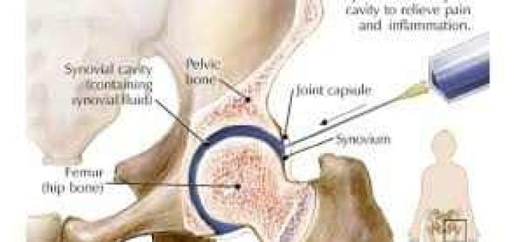 Shark Cartilage: properties, benefits, and contraindications