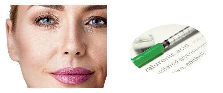 What Hyaluronic Acid Is and What It Is Used For in Aesthetics and Medicine Results of Hyaluronic acid before and after