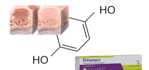 Hydroquinone in cream, ointment, and gel: what it is and HOW TO USE the treatment