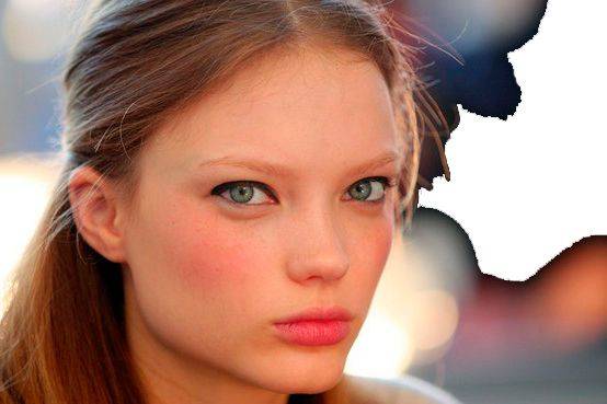 What Hyaluronic Acid Is and What It Is Used For in Aesthetics and Medicine Cheekbone Filler and Enhancement with Hyaluronic Acid
