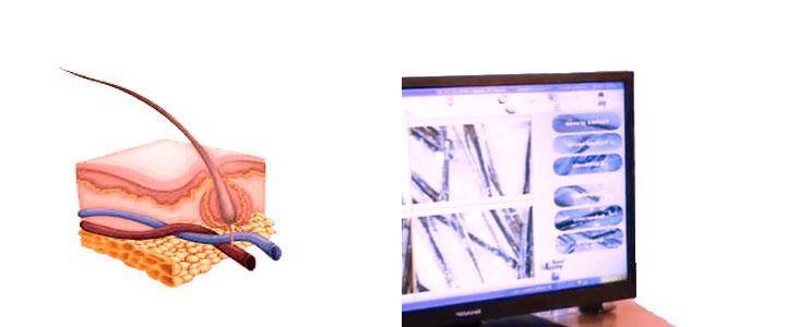 Trichology or hair science, differences between trichologist and dermatologist The trichologist performs trichology sp
