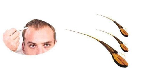 Trichology or hair science, differences between trichologist and dermatologist Trichology or hair science, differences between trichologist and dermatologist