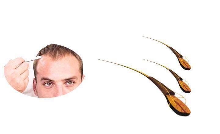 Trichology or hair science, differences between trichologist and dermatologist What is trichology and what is it for