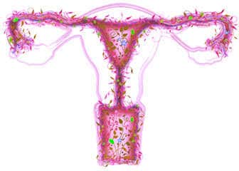 Vaginal probiotic