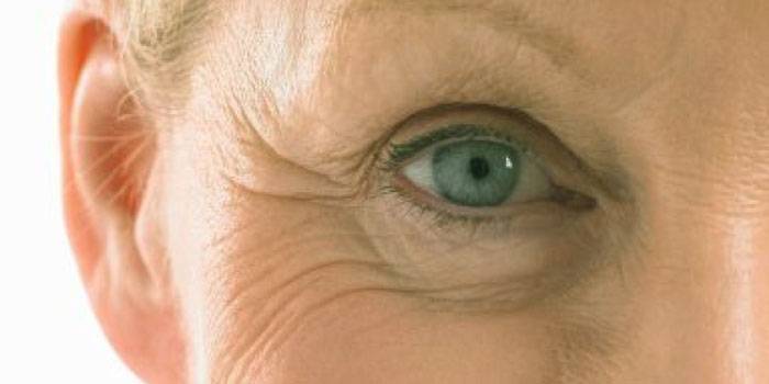 Woman with wrinkles on her face