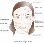Relleno arrugas faciales con ácido hialurónico