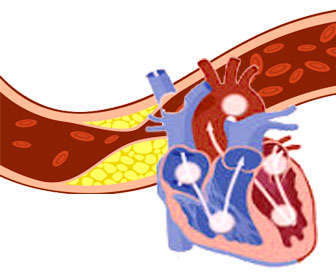 imagen diabetes, colesterol y salud cardiovascular
