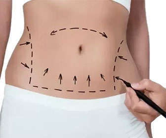 hidrolipoclasia qué es y cómo funciona