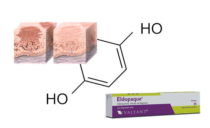 hidroquinona que es