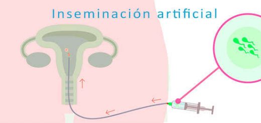 inseminacion artificial pasos