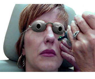  tratamiento laser n yag ojeras