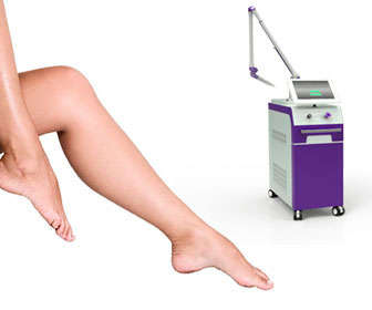 laser yag para depilacion