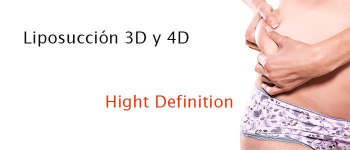 Liposucción 3D High Definition