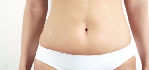 liposuccion abdominal precio resultados abdomen