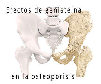 osteoporosis y densidad ósea