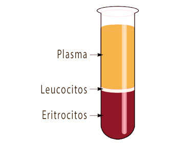 solución a la alopecia Solución a la alopecia femenina y masculina androgénica y areata ¿Es definitiva? plasma rico en plaquetas para la caída del cabello