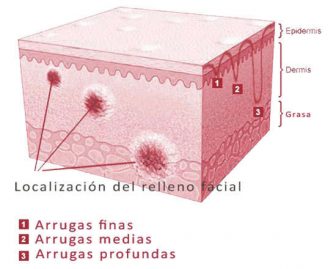 Estructura del relleno dermico